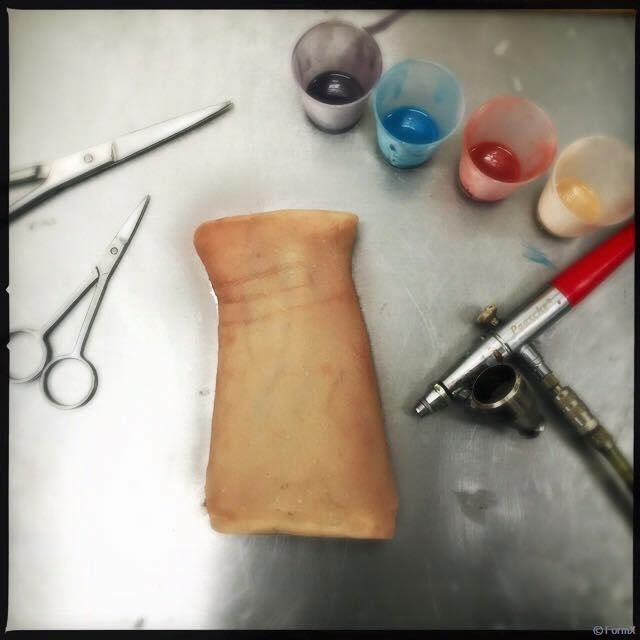 Prosthetic Materials